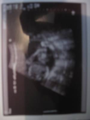 5 months - Thank goodness she looks just like her mommy!!!